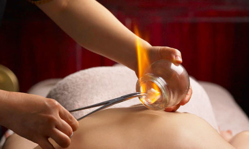 <h2>Fire Cupping</h2><div class='slide-content'><p><span class='highlight'></span></p><p><span class='highlight'>fire cupping is a type of deep tissue massage that promotes stress relief and relaxation. As a medicinal therapy, cupping has been used with bronchitis, asthma, colds, digestive diseases, musculoskeletal pain, some gynecological disorders, gastro-intestinal disorders, lung diseases, and paralysis as well as for other disorders. </span></p></div><a href='https://naturalhealthatlantic.ca/fire-cupping/' class='btn' title='Read more'>Read more</a>
